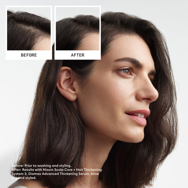 Nioxin Scalp + Hair Thickening System 3, Xmas Kit