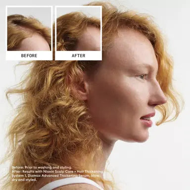 Nioxin  Scalp + Hair Thickening System 1 Conditioner 300ml