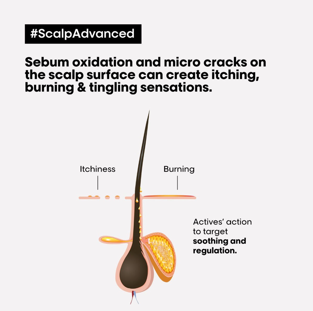 Serie Expert Scalp Advanced Soothing Treatment 200ml Peter Mark