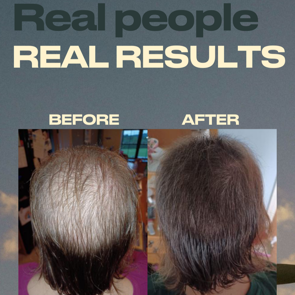 Annutri Grow It Hair Supplements 1 Month Supply (60 Capsules)