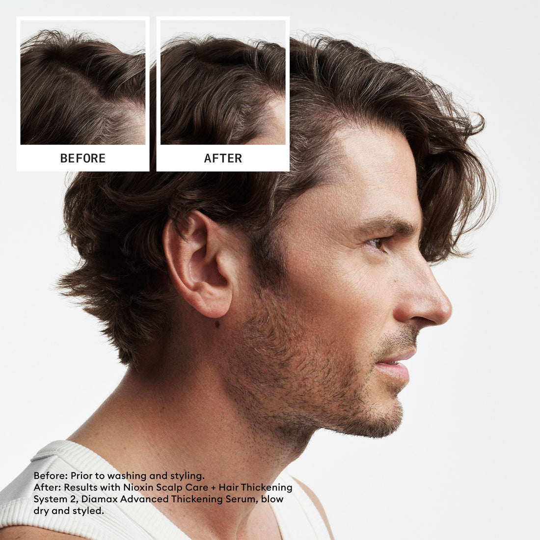 Nioxin Scalp + Hair Thickening System 2, Xmas Kit
