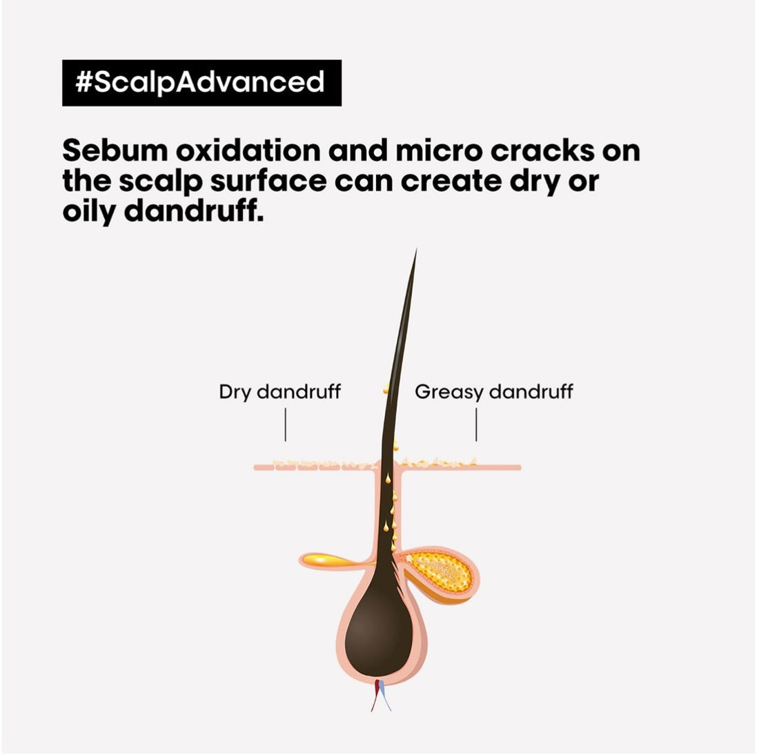 Serie Expert Scalp Advanced Dermo-clarifier Shampoo 300ml